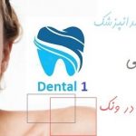 دندانپزشکی زیبایی در ونک | بهترین دندانپزشک و دندانپزشکی زیبایی در ونک