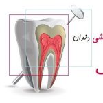 مرکز عصب کشی دندان در ونک | مرکز تخصصی عصب کشی دندان ونک