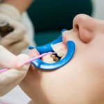 معایب و مزایا بلیچینگ دندان چیست ؟