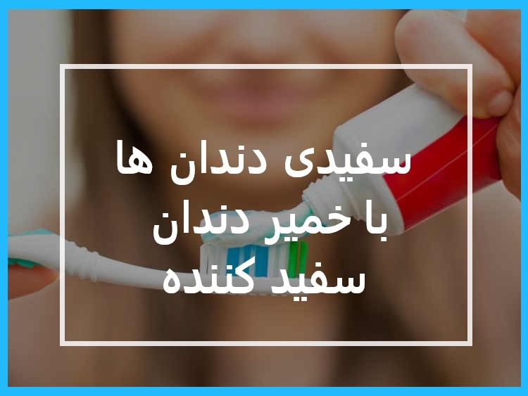 خمیر دندان سفید کننده