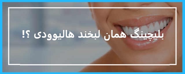 بلیچینگ 