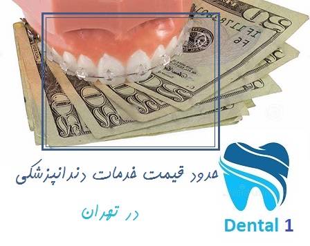 حدود قیمت خدمات دندانپزشکی در تهران