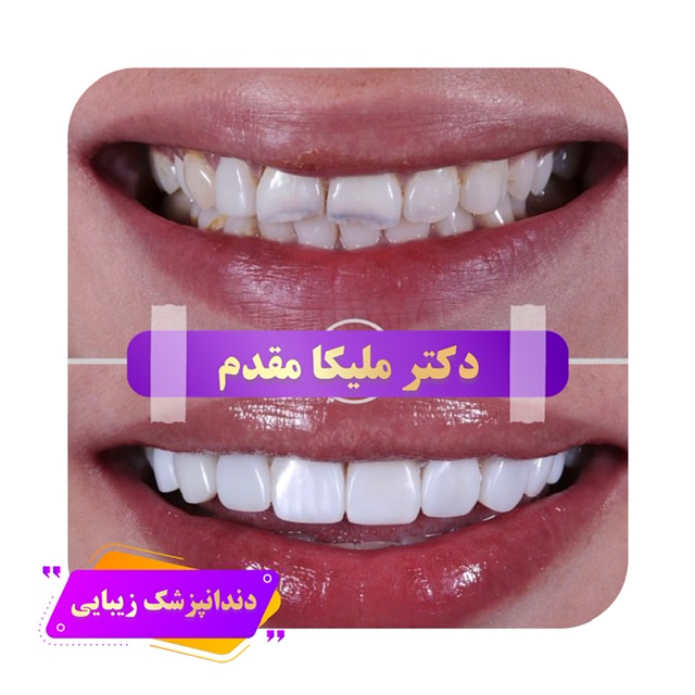 دندانپزشک زیبایی شرق تهران