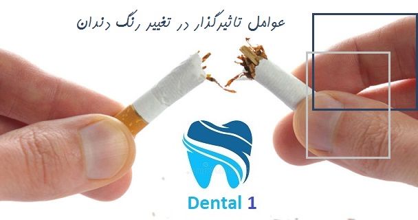 عوامل تاثیرگذار در تغییر رنگ دندان