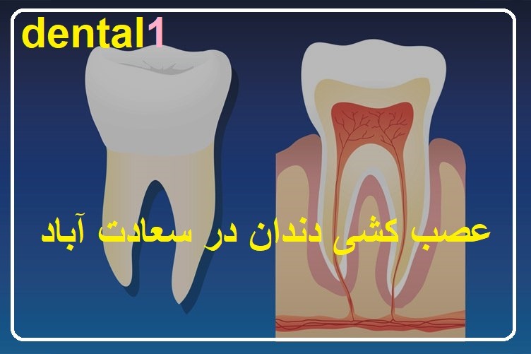 عصب کشی دندان در سعادت آباد 