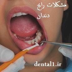 مشکلات رایج دندانپزشکی