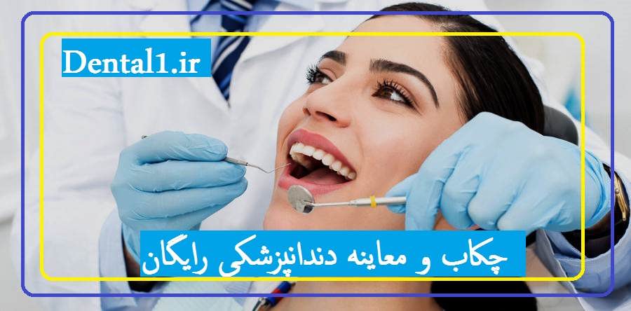 چکاب و معاینه دندانپزشکی رایگان