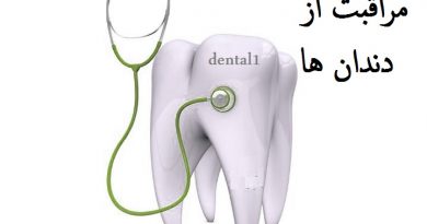 مراقبت از دندانها