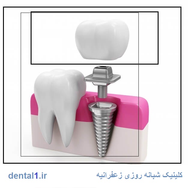 دندانپزشکی شبانه روزی زعفرانیه