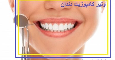 بهترین مرکز ونیر کامپوزیت دندان در تهران