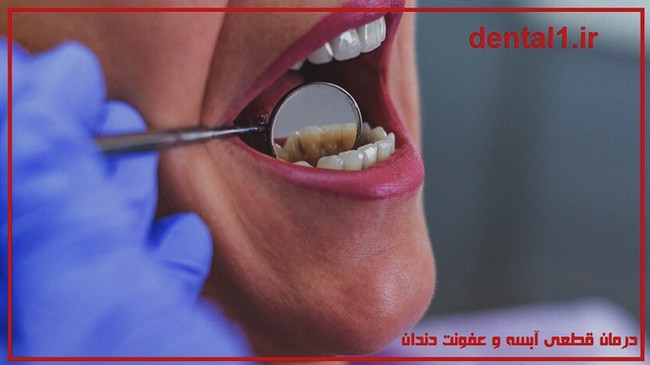 درمان قطعی آبسه و عفونت دندان