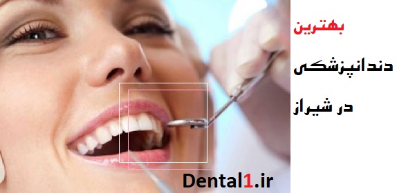 بهترین دندانپزشکی در شیراز