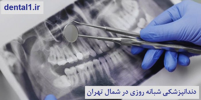 دندانپزشکی شبانه روزی در شمال تهران