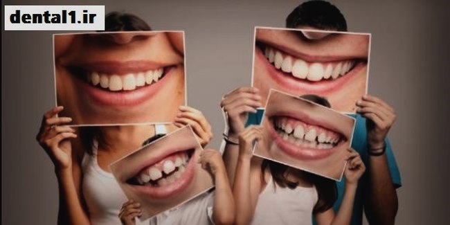مراقبت از دندان ها و نکات مهم آن