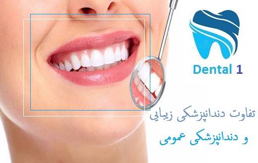 تفاوت دندانپزشکی زیبایی با دندانپزشکی عمومی چیست؟