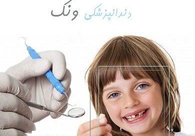 روش کشیدن دندان در دندانپزشکی ونک