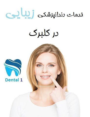 خدمات دندانپزشکی زیبایی در گلبرگ