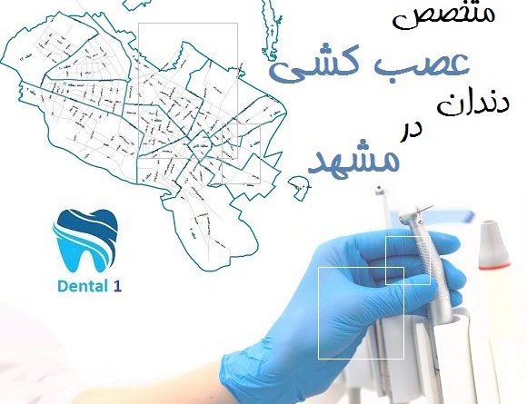 متخصص عصب کشی دندان در مشهد