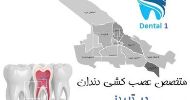 متخصص عصب کشی دندان در تبریز