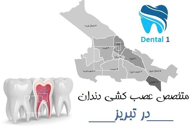 متخصص عصب کشی دندان در تبریز