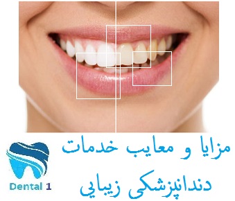 مزایا و معایب خدمات دندانپزشکی زیبایی