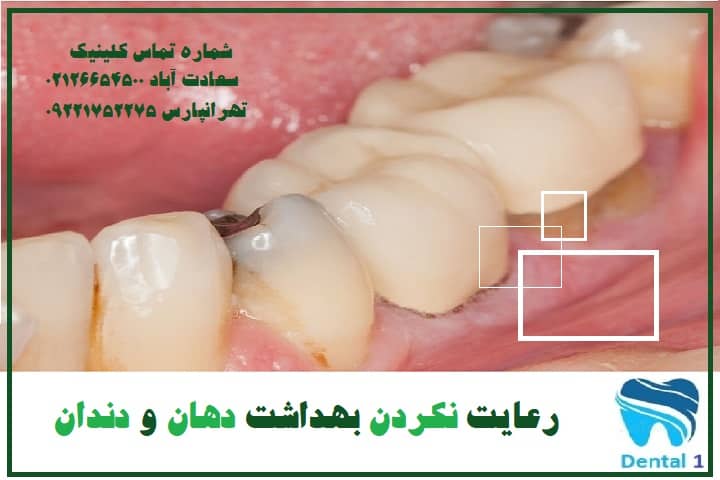 رعایت نکردن بهداشت