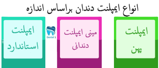 انواع ایمپلنت دندان براساس اندازه