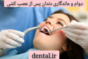 دوام و ماندگاری دندان پس از عصب کشی