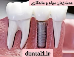 مدت زمان دوام و ماندگاری