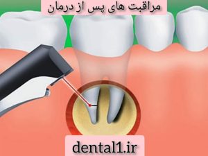 مراقبت های پس از درمان