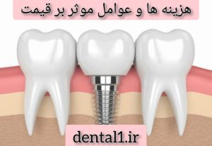 هزینه ها و عوامل موثر بر قیمت